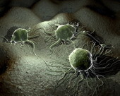 Cancer Cells 1