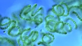 Cyanobacteria from toxic bloom, LM
