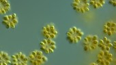Synura sp golden algae, LM