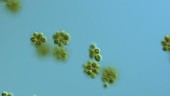 Synura petersenii golden algae, LM