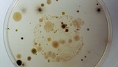 Bacteria growing in a petri dish, time-lapse footage