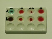 Blood group test results