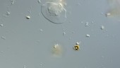 Vanella amoeba timelapse, LM