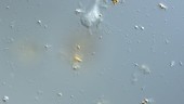 Leptophrys amoeba timelapse, LM