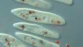 Paramecium fed on stained yeast