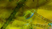 Ciliates feeding on diatoms, light microscopy footage