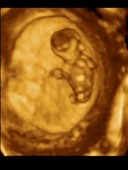 12-week-old foetus, 3D ultrasound scan