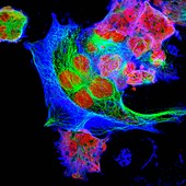 Neuroblastoma cells, fluorescence light micrograph