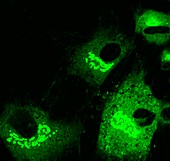 Mesenchymal stem cells, fluorescence light micrograph