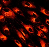 Fibroblast skin cells, fluorescence light micrograph