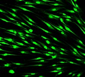 Fibroblast skin cells, fluorescence light micrograph