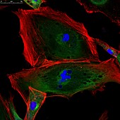 Fibroblast skin cells, fluorescence light micrograph