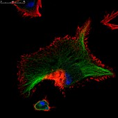 Fibroblast skin cells, fluorescence light micrograph