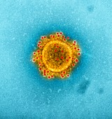 MERS coronavirus particle, TEM