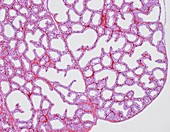 Lachrymal gland, light micrograph