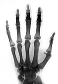 Hand X-ray, 1896