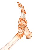 Human foot, 3D CT scan