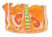 Liver and spleen and kidneys, 3D CT scan
