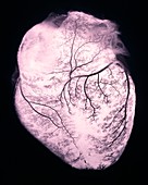 Heart with arteries