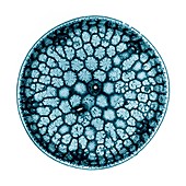 Centric diatom, TEM