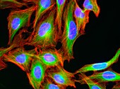 HeLa cervical cancer cells, fluorescence light micrograph