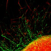 Nerve cell, fluorescence light micrograph