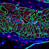 Muscle fibre, confocal fluorescence light micrograph