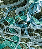 Umbilical cord collagen, SEM