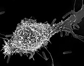 Peritoneal macrophage phagocytosis of E. coli, SEM