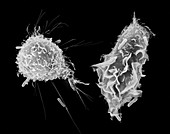 Macrophage and monocyte phagocytosis, SEM