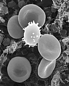 Red blood cells, white blood cell and platelets, SEM