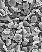 Red blood cells, white blood cells and platelets, SEM