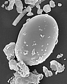 Dust mite egg (Dermatophagoides sp.), SEM