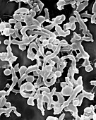 Helicobacter pylori, SEM