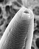 Soil nematode stomodeum (Caenorhabditis elegans), SEM