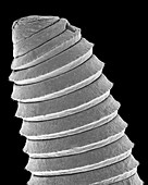 Detritus worm (Class Annelida), SEM