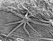 Plant leaf trichome (Hibiscus sp.), SEM