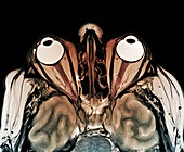 Human eyes and brain, MRI scan