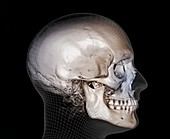 Human skull, 3D CT scan