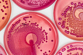 Bacteria cultures in MacConkey agar