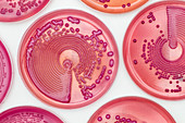 Bacteria cultures in MacConkey agar
