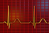 ECG, illustration