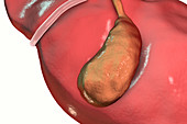 Healthy gallbladder, illustration