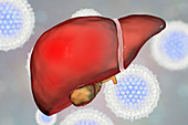 Hepatitis C, illustration