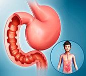 Child's stomach and duodenum, illustration