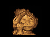 Foetus, ultrasound scan