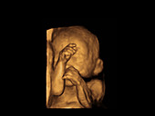 Foetus, ultrasound scan
