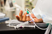 Cannula in a patient's hand