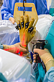 Hand arthroscopy