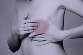 Breast cancer, conceptual image